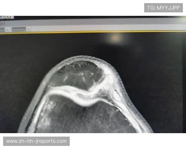 穆迪遭遇膝盖变形重伤无对抗下突发伤情致比赛转播信号中断 穆迪遭遇膝盖变形重伤无对抗下突发伤情致比赛转播信号中断